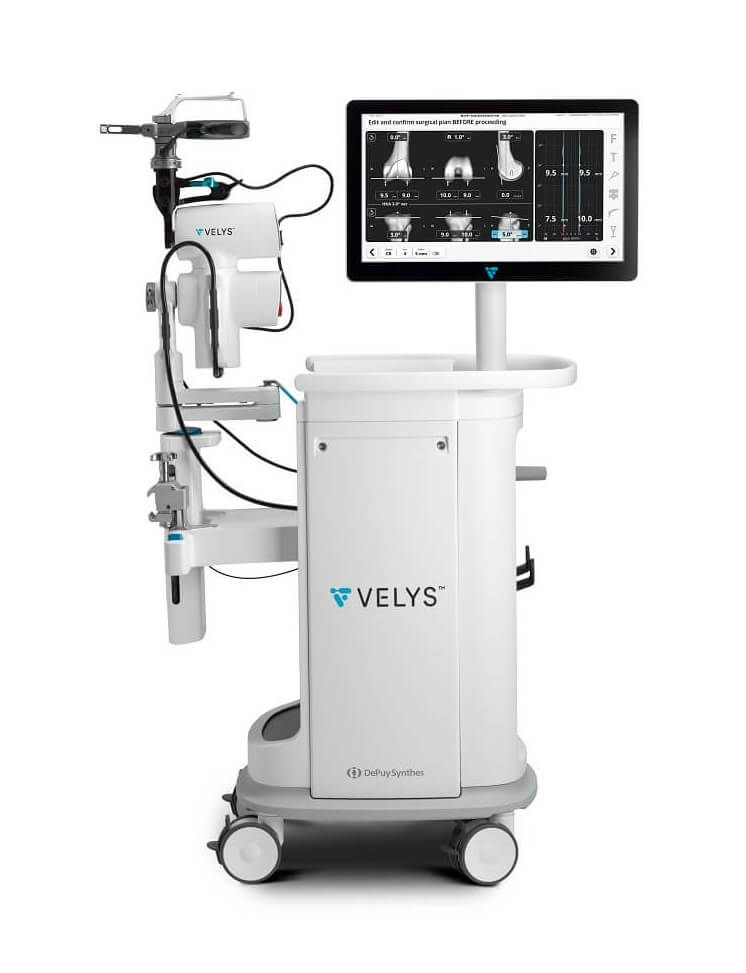 Velys robotic assisted solution machine