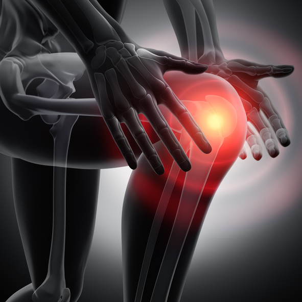 3d render human knee with pain symptoms - side view - Grayscale Image