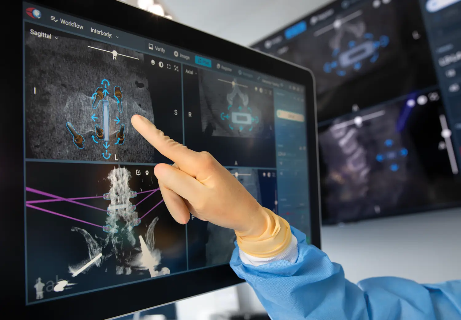 Surgeon using an excelsius robot